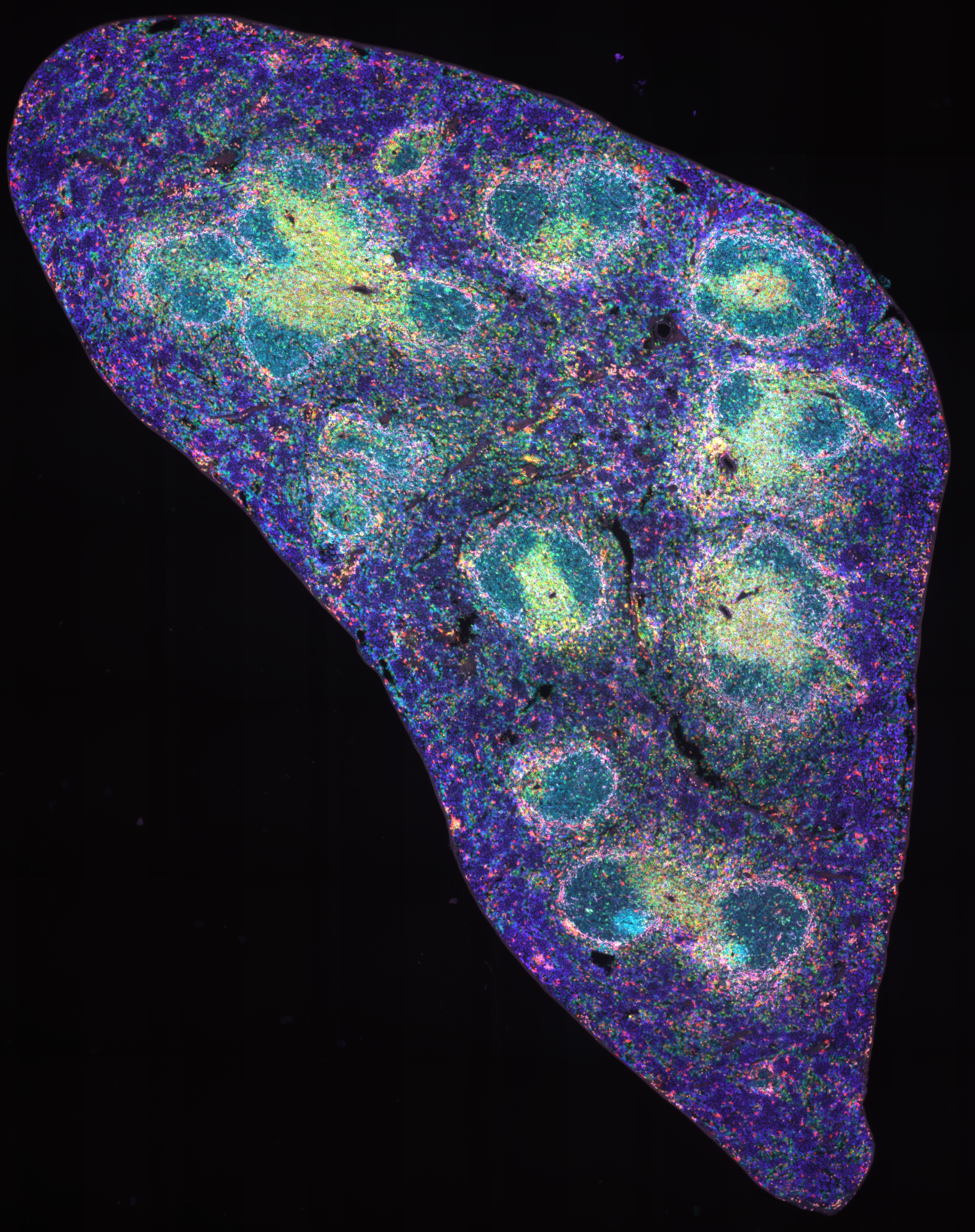 Mouse spleen stained with StreptaClick HRP 8-color, imaged with SpectraSplit 10 optical filter sets
