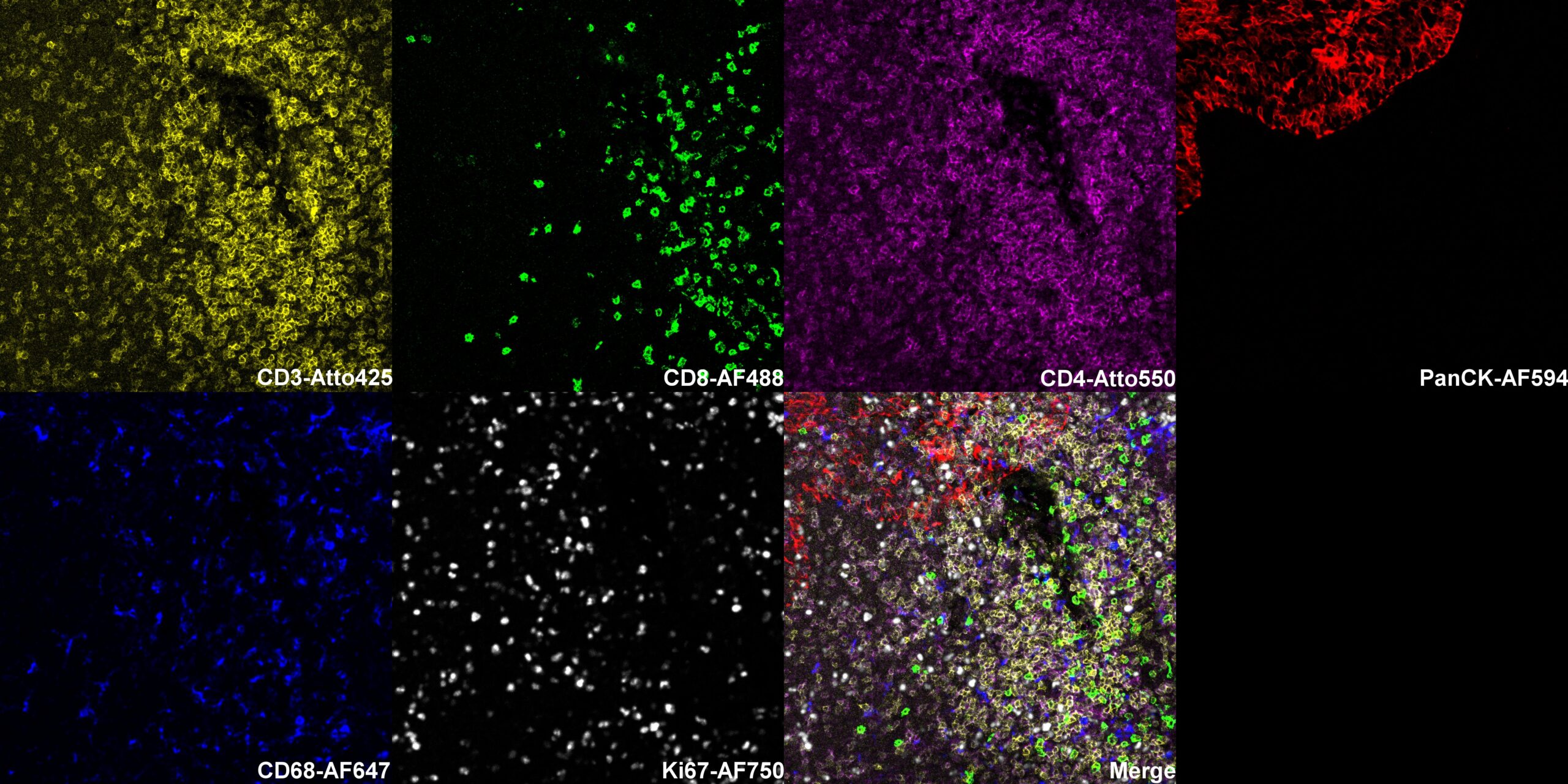 StreptaClick® Precision in combination with arcoris bio's MUSE multiplex oligo-based signal amplification technology